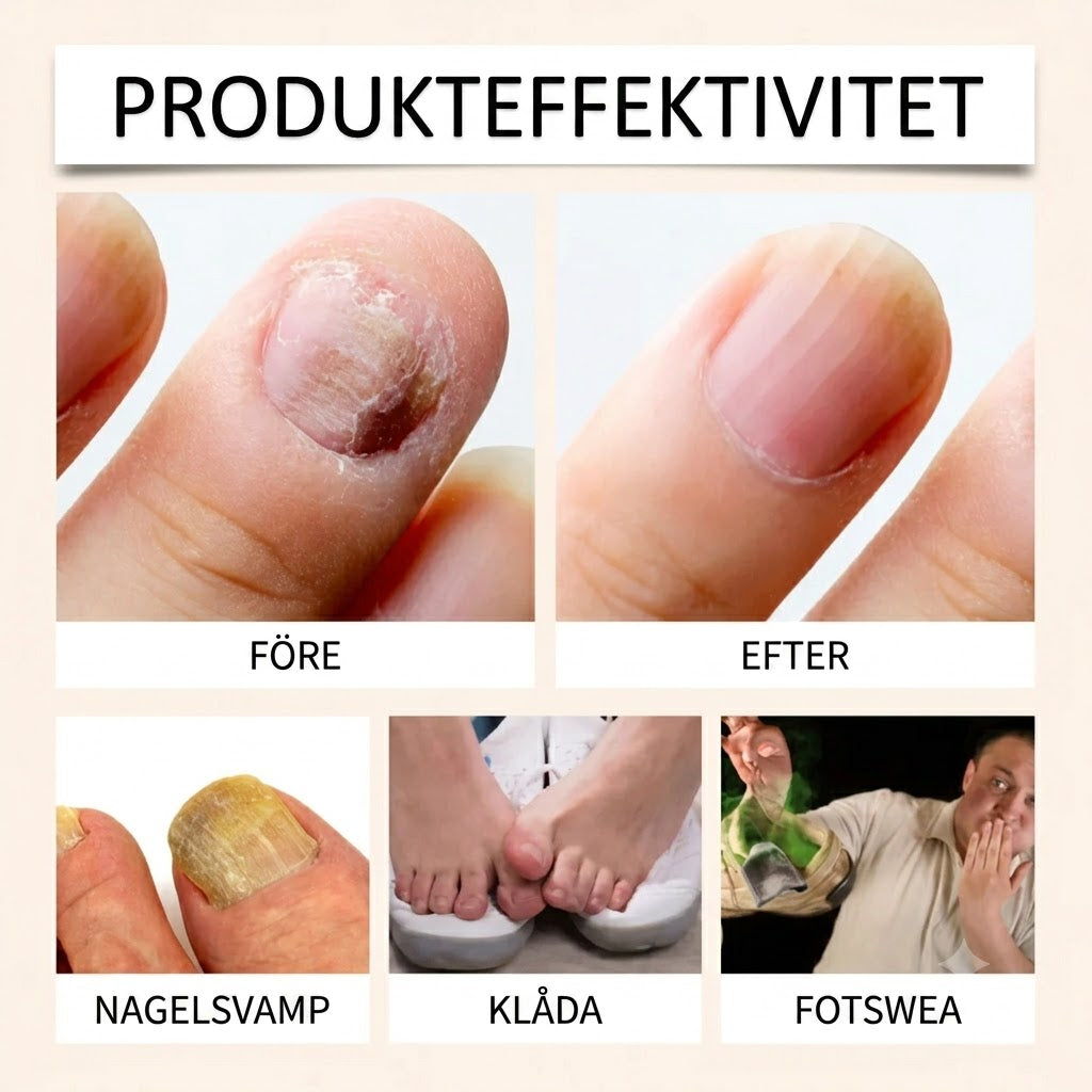 Nagelspray med bigift – effektiv vård för dina naglar
